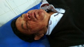 নরসিংদী-২ (পলাশ): হামলায় মঈন খানের ব্যক্তিগত সহকারী আহত নরসিংদী-২ (পলাশ): হামলায় মঈন খানের ব্যক্তিগত সহকারী আহত