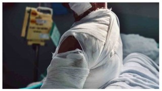 নরসিংদীতে ছাত্রী দগ্ধের ঘটনায় মামলা