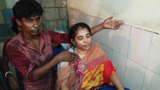 নরসিংদীতে কলেজ ছাত্রীর শরীরে অগ্নিসংযোগ 