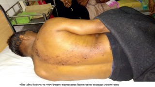 পলাশে মজার ছলে মানসিক ভারসাম্যহীন ব্যক্তির শরীরে দাহ্য পদার্থ নিক্ষেপ করলো দুই যুবক ! পলাশে মজার ছলে মানসিক ভারসাম্যহীন ব্যক্তির শরীরে দাহ্য পদার্থ নিক্ষেপ করলো দুই যুবক !