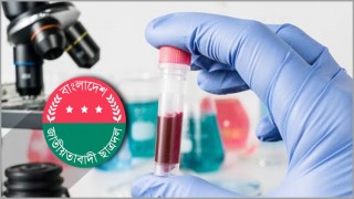 ডোপ টেস্টের মাধ্যমে ছাত্রদলের নেতৃত্ব নির্বাচনের চিন্তা ডোপ টেস্টের মাধ্যমে ছাত্রদলের নেতৃত্ব নির্বাচনের চিন্তা