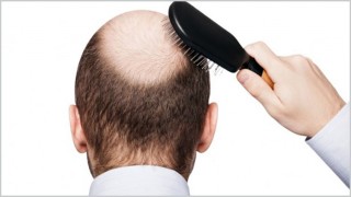 মাথায় টাক পড়ার কারণ বায়ু দূষণ