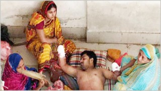 ইউপি চেয়ারম্যান কর্তৃক যুবকের দুইহাত কর্তন