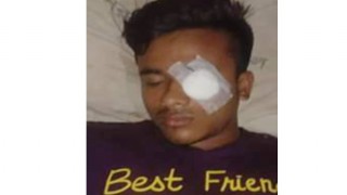 বেলাবতে অধ্যক্ষের বিরুদ্ধে শিক্ষার্থীকে পিটিয়ে আহত করার অভিযোগ