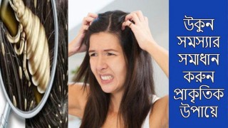 সহজে তাড়ান মাথার উকুন!