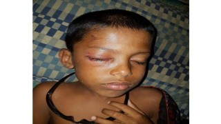 বেলাবতে মাদকসেবীদের হামলায় আহত ৬