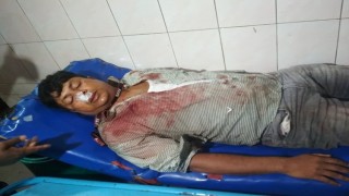 রায়পুরায় চেয়ারম্যান ও তার সন্ত্রাসী বাহিনীর হামলায় সাংবাদিক আহত