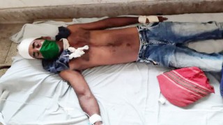 বেলাবতে প্রতিপক্ষের হামলায় দুইজন আহত
