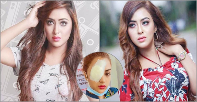 কন্টাক্ট লেন্স গলে চোখের সমস্যায় চিত্রনায়িকা তানহা কন্টাক্ট লেন্স গলে চোখের সমস্যায় চিত্রনায়িকা তানহা