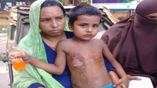 বৃদ্ধের কাণ্ডে শিশুটির এমন দশা!