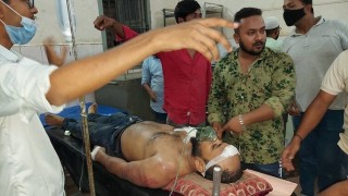 ইউপি চেয়ারম্যানের সমর্থকদের হামলায় সাবেক চেয়ারম্যানের ছেলে আহত