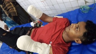 পলাশে চাচীর সাথে পরকীয়ার অভিযোগে যুবকের দুই হাতের কব্জি কাটলেন ফুফা